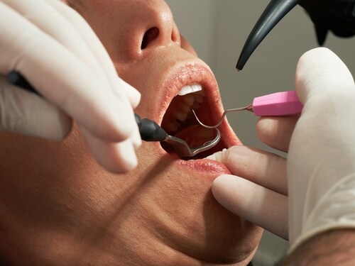 How a Visit to the Dentist Can Change Your Perspective on Your Oral Health